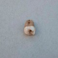 Human adult molar, Square 23, 280 cm. © EISP.ORG 2014